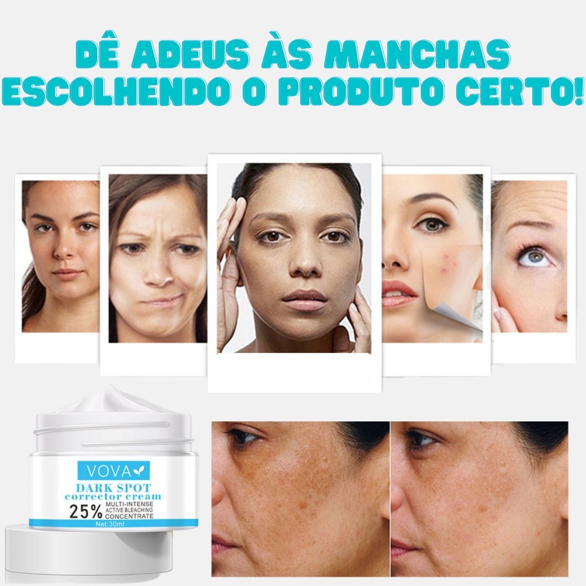 Creme para Melasma - Melaslow - viya-stores