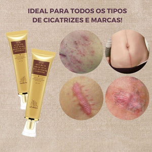 Gel Removedor de Cicatriz e Clareador de Manchas - Perfect Skin + Brinde - viya-stores