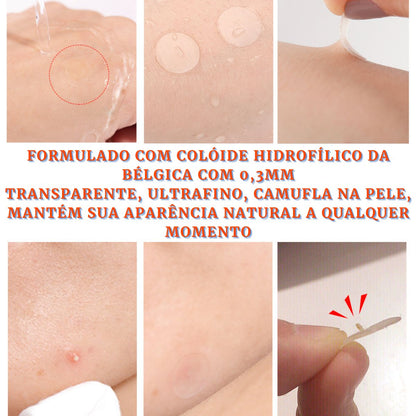 Kit Adesivo Curativo para Acne Dia e Noite - viya-stores