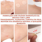 Kit Adesivo Curativo para Acne Dia e Noite - viya-stores
