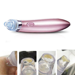 Removedor de Cravos e Espinhas - Beautiful Clean - viya-stores